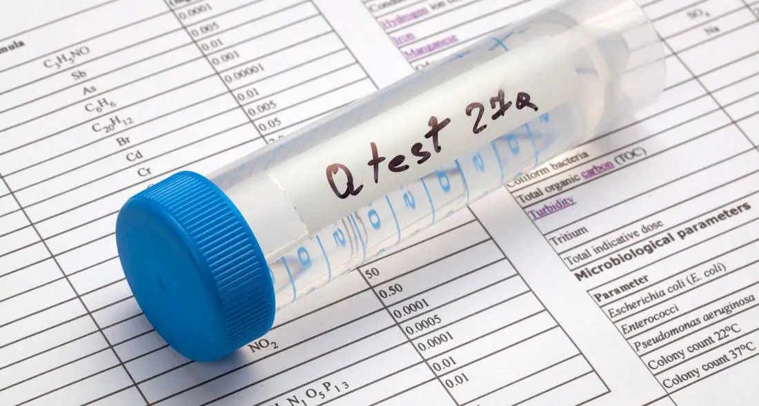 18 Best Water Quality Testing Kits: Reviews, Ratings, and More