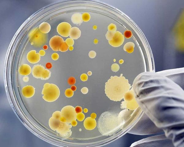 Testing-for-bacteria Testing for bacteria